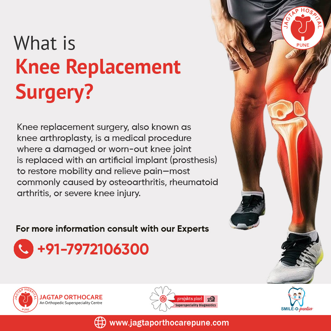 best orthopedic surgeons in Pune